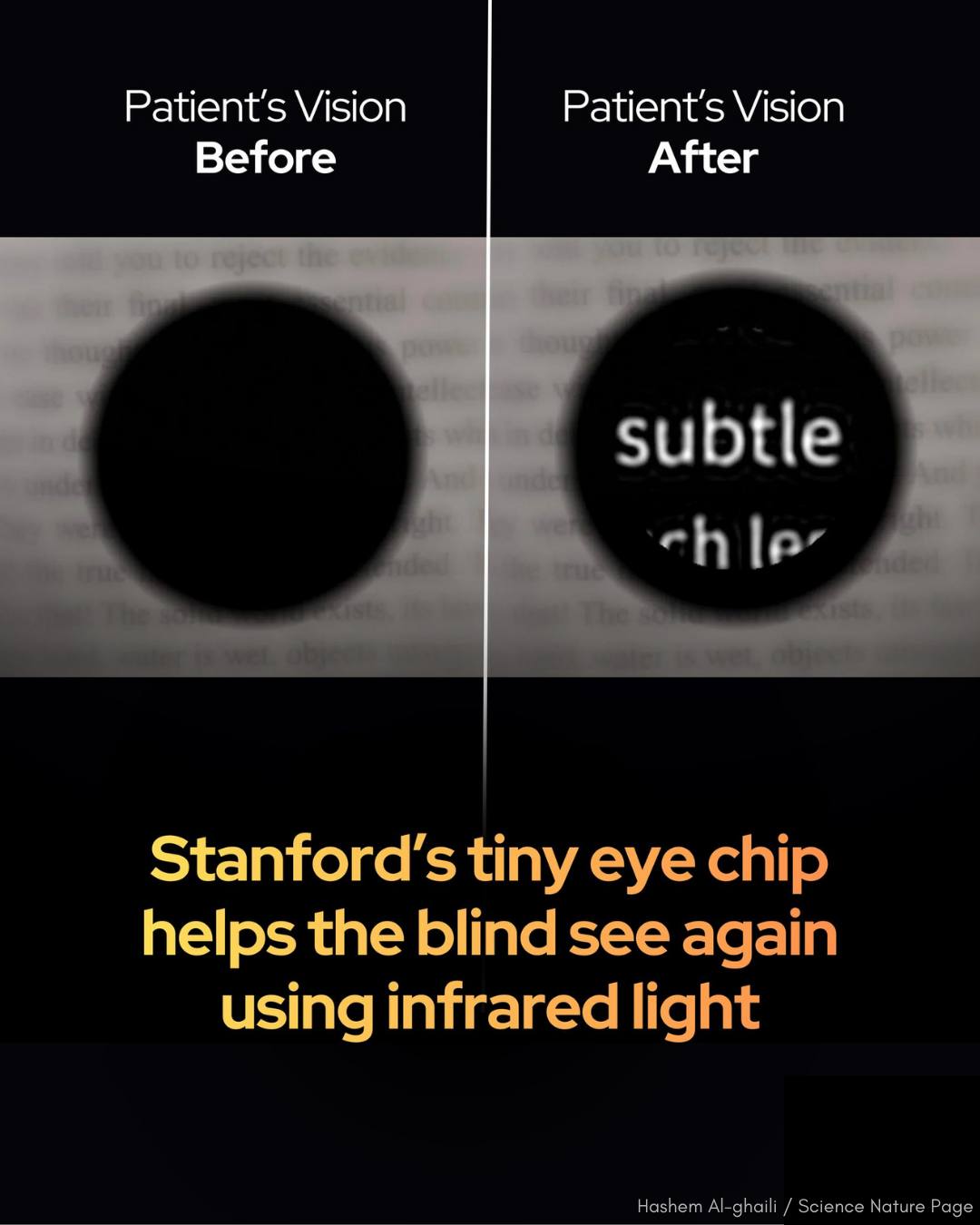 Hashem - 👁️ A bionic eye just restored sight and let people read again ...
