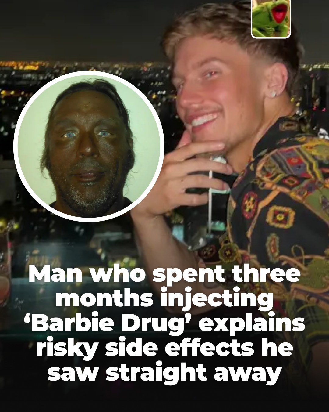 how long does melanotan last reddit A user who documented three months of injecting the so-called 