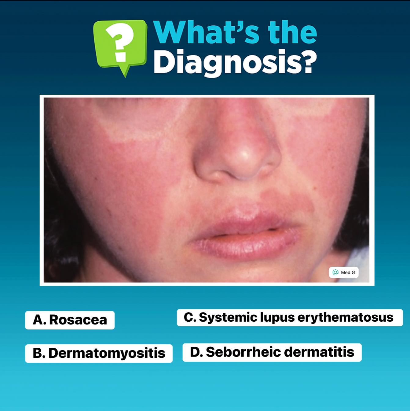 Med - A 26-year-old woman presents with fatigue, joint pain, and a ...