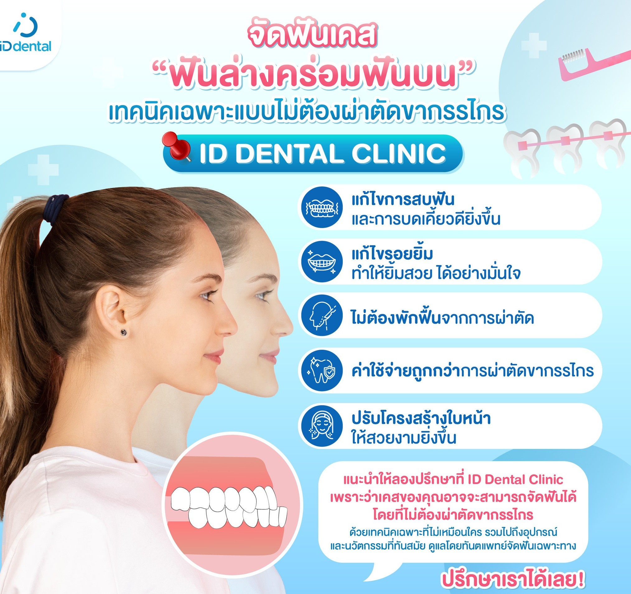 ID - จัดฟันเคสยาก แบบไม่ต้องผ่าตัดขากรรไกร ด้วยเทคนิคเฉพาะ 📌 ID Dental ...