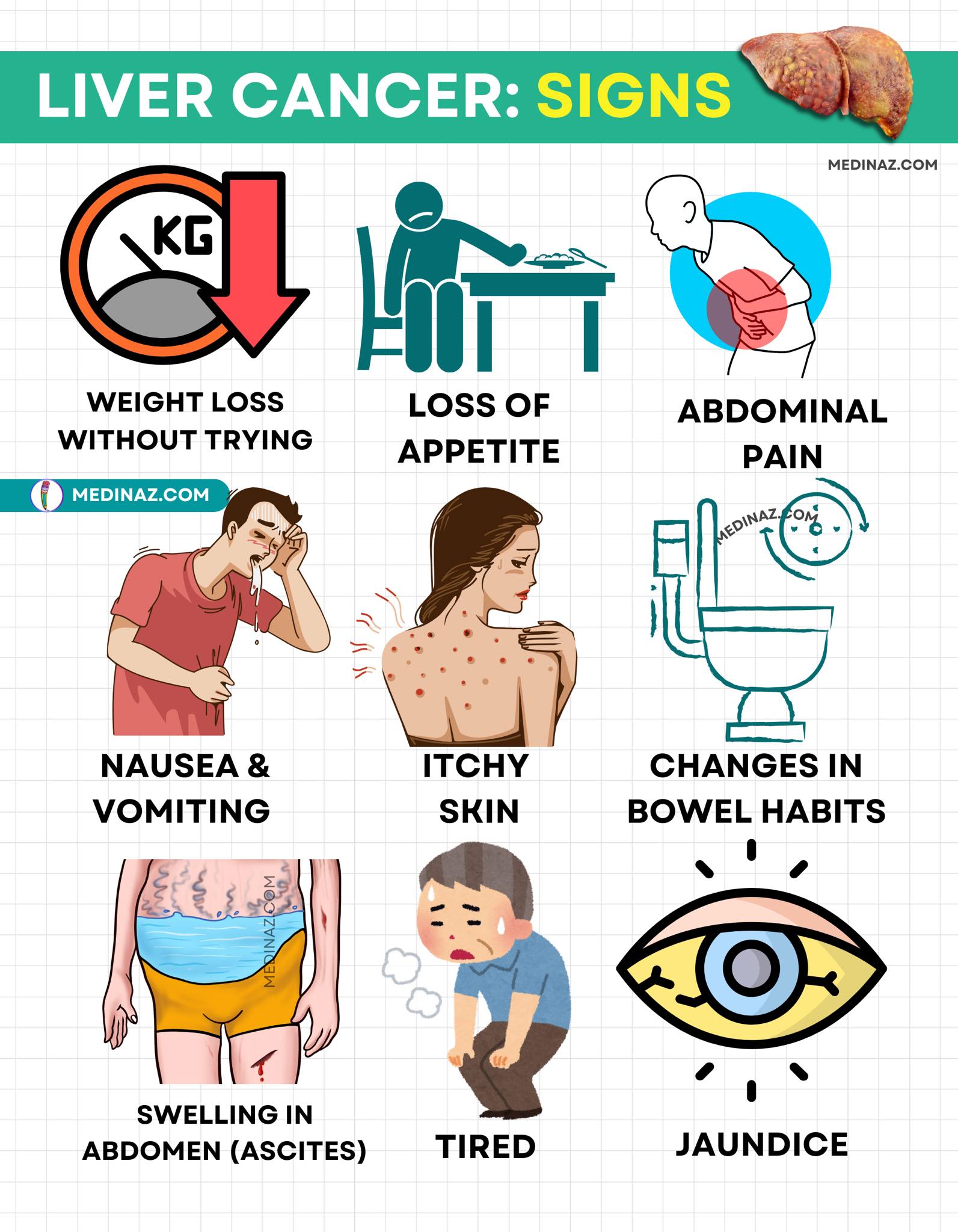 Medinaz - Signs of liver cancer overview | Facebook