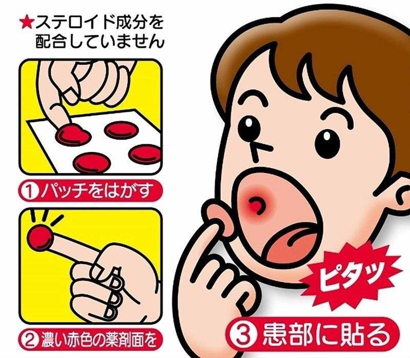 好易購 - 🇯🇵日本大正製藥痱滋貼10片 產品介紹 * 快速舒緩因口腔炎、口腔潰瘍或口舌炎症等引起的不適 *... | Facebook