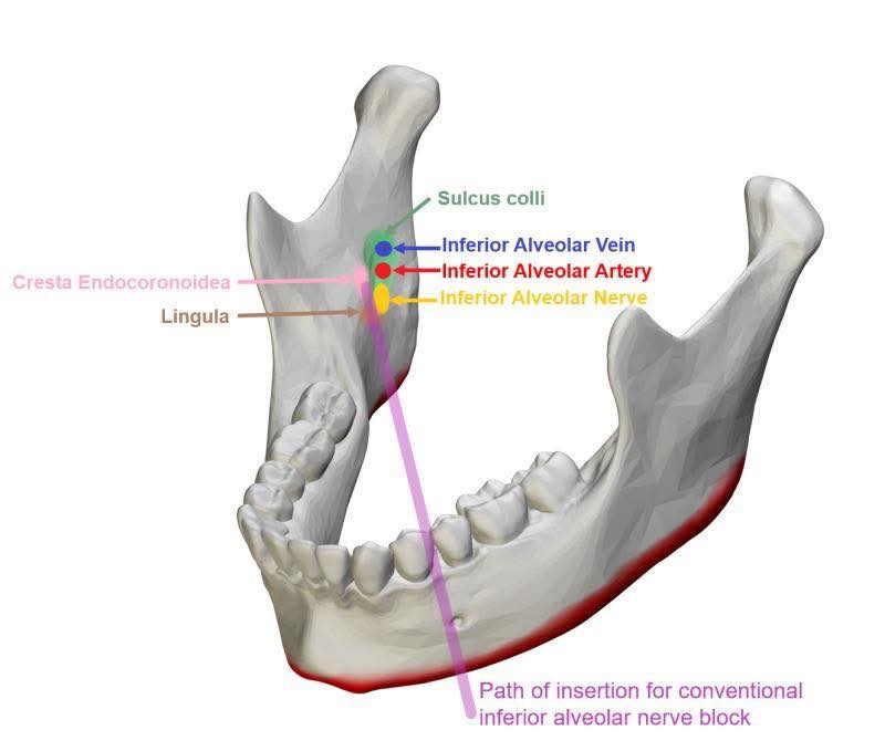 Dental Clinical Skills Arcade - NDEB/ADC/NBDE/Bench Tests added a new ...