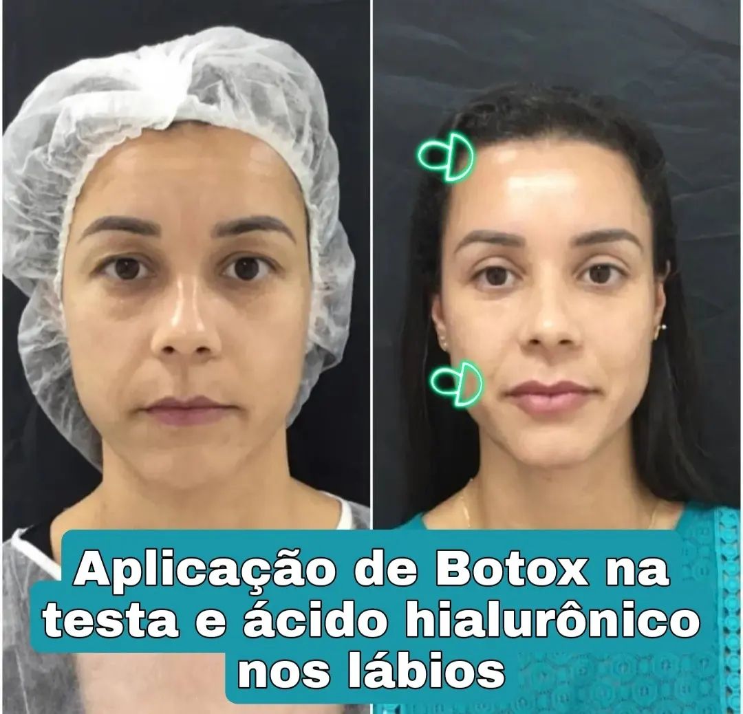 A paciente me enviou a foto como... - Clínica Mariana Bubanz
