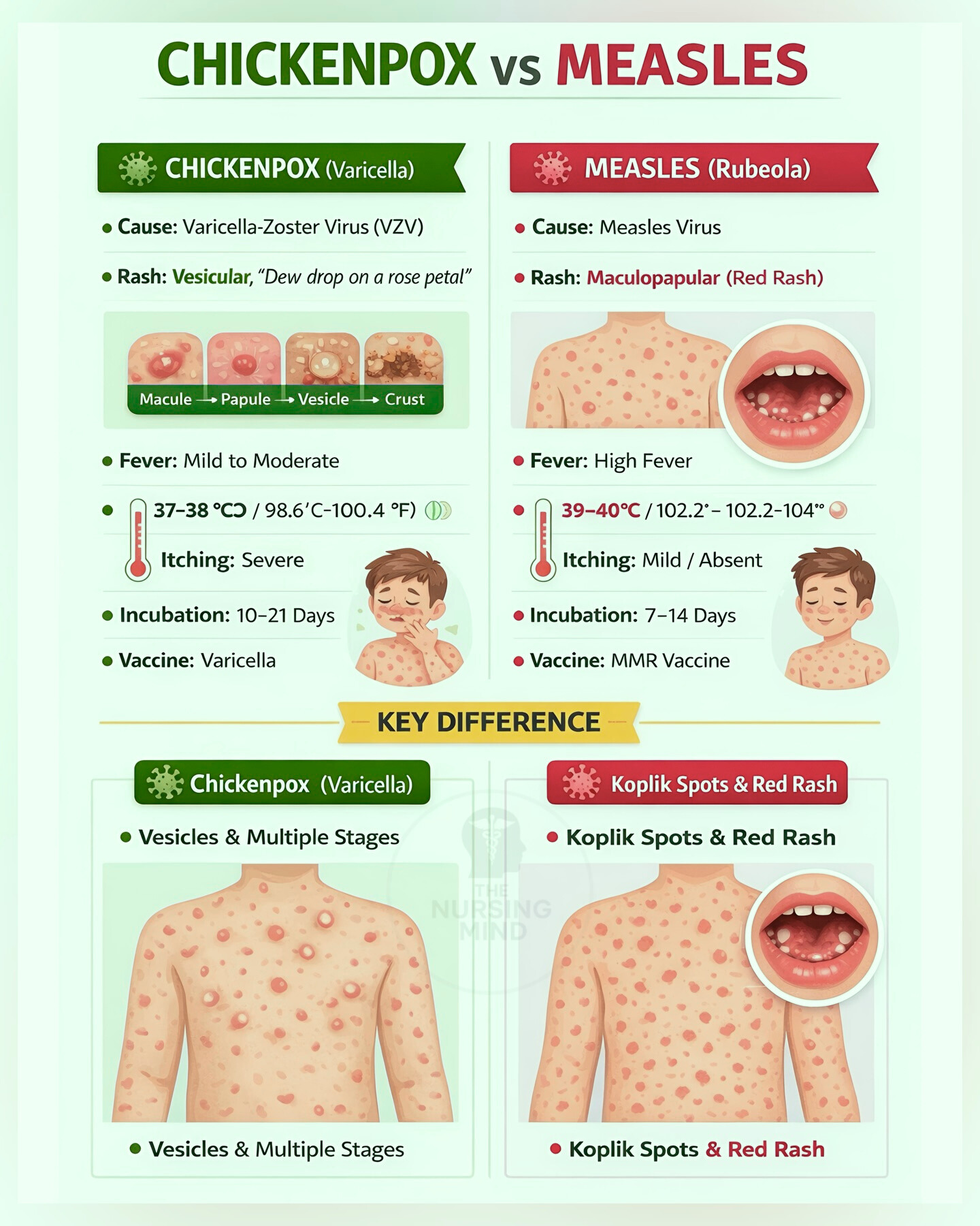 HSU - Visual comparison of Chickenpox vs Measles Infection ctto # ...