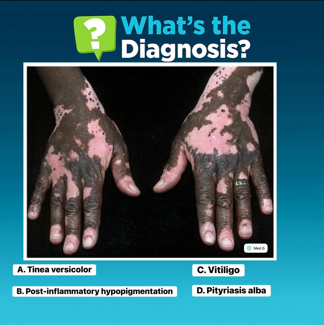 Med - A 34-year-old woman presents with progressive, asymptomatic light ...