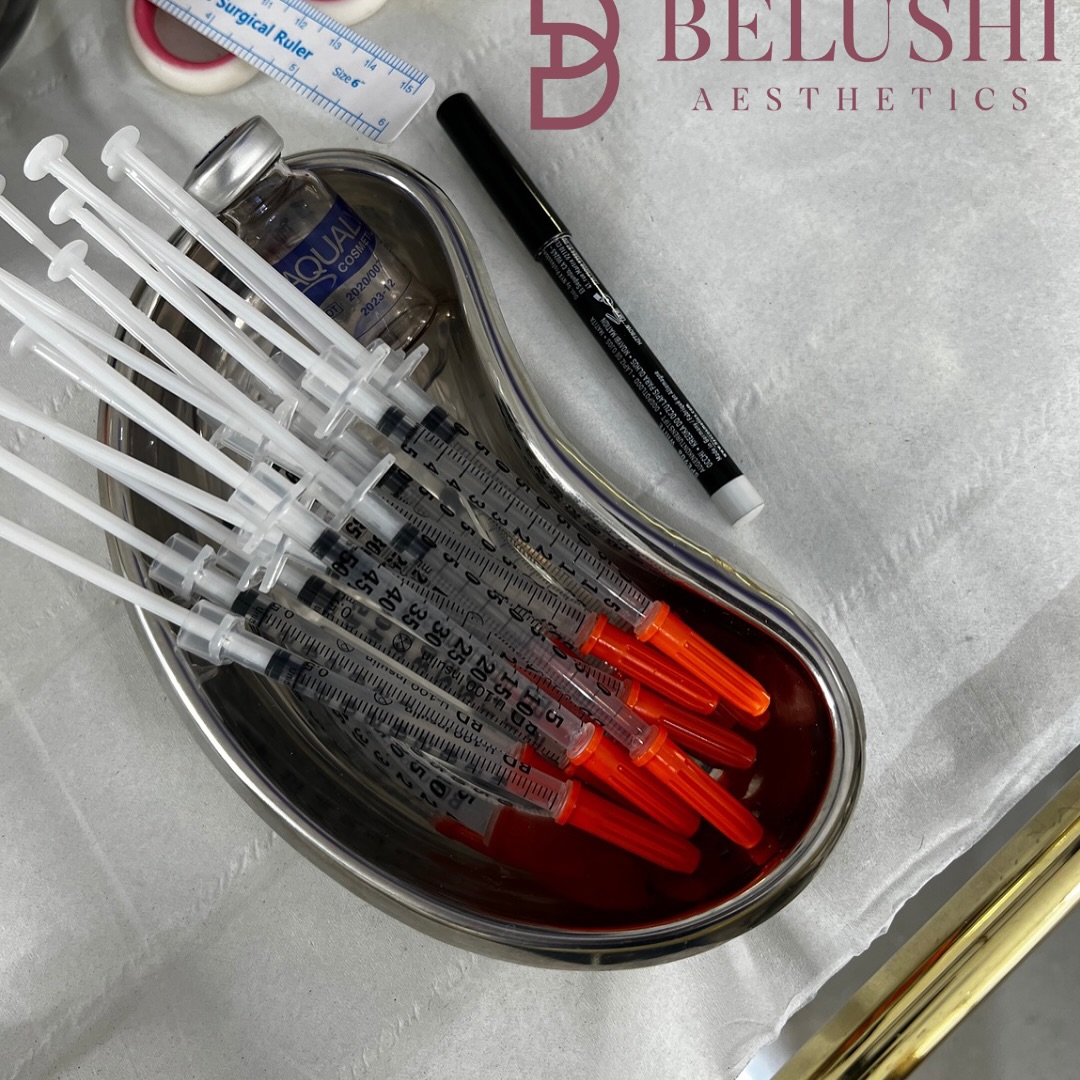 Belushi Aesthetics - How Do PDO Thread Lifts Work? PDO threads are ...