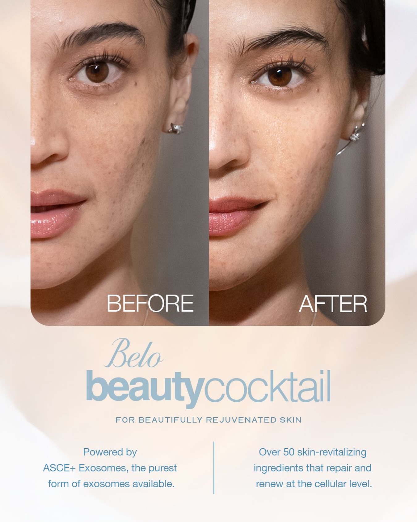 Achieve beautifully rejuvenated skin with our signature Belo Beauty Cocktail 😌 This multi-action skin rejuvenation treatment works at the cellular level to help improve skin radiance, firmness, hydration, and elasticity from within