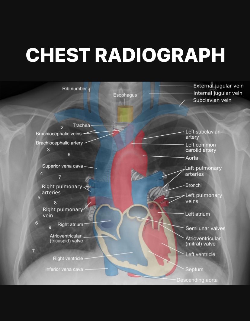 Medinaz - Chest Radiograph Identification | Facebook