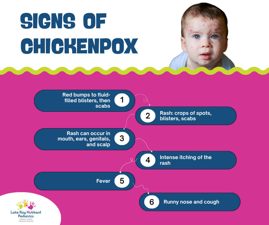 Lake - Chickenpox is a common childhood illness that's usually mild ...