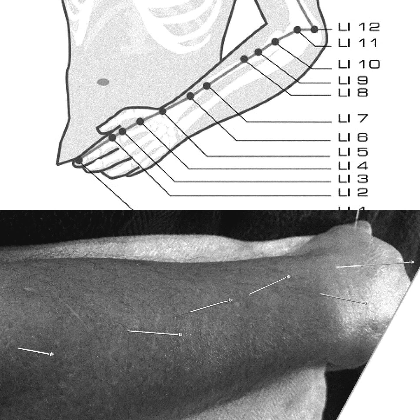 Optimum - The Large Intestine (LI) meridian runs from the tip of the ...