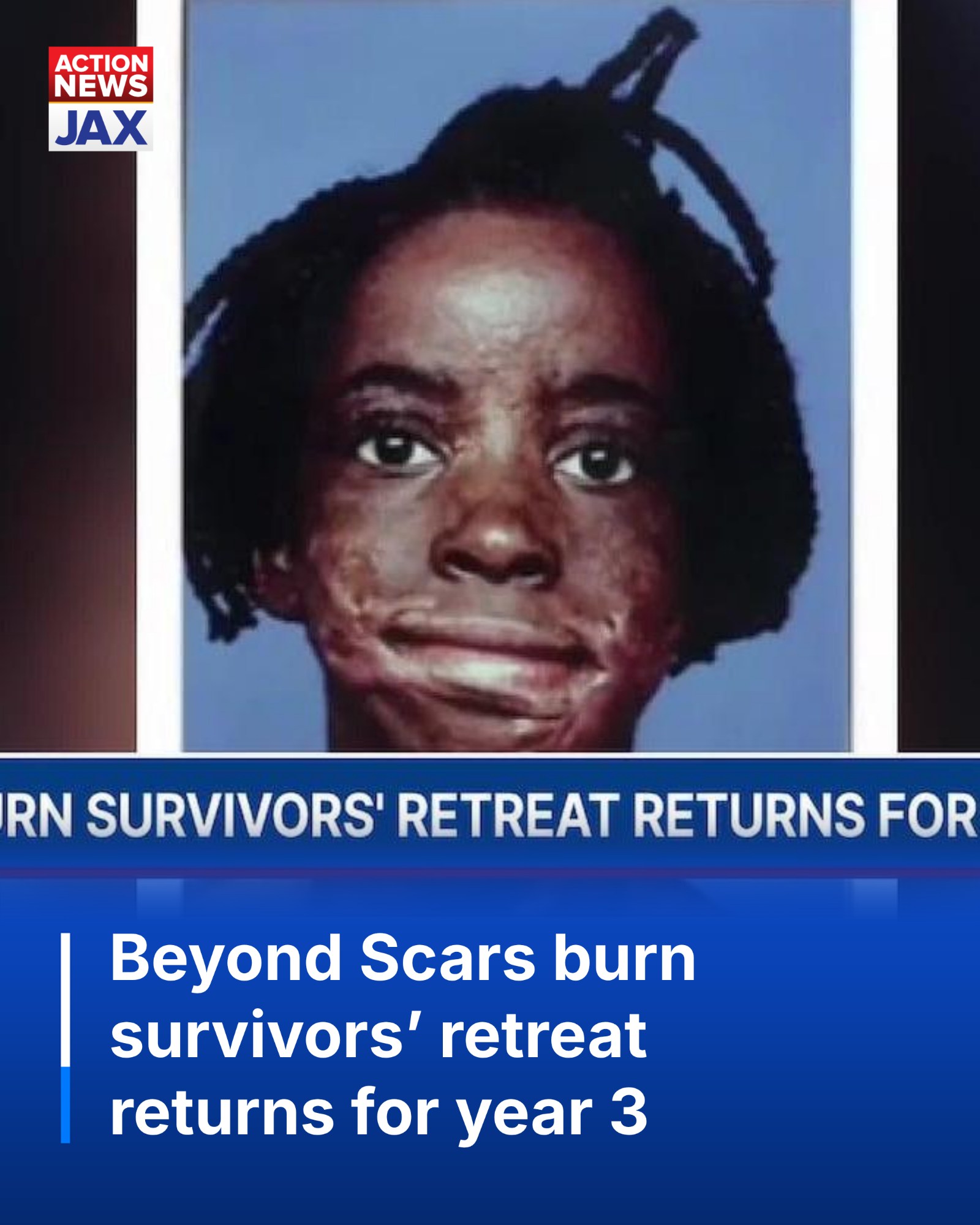 Local organization Beyond Scars is hosting its annual retreat for