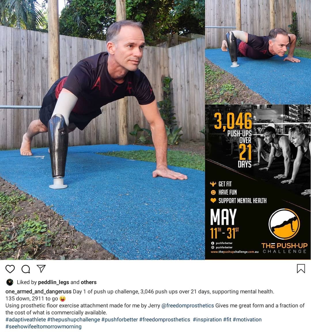 Freedom Prosthetics | Cairns QLD