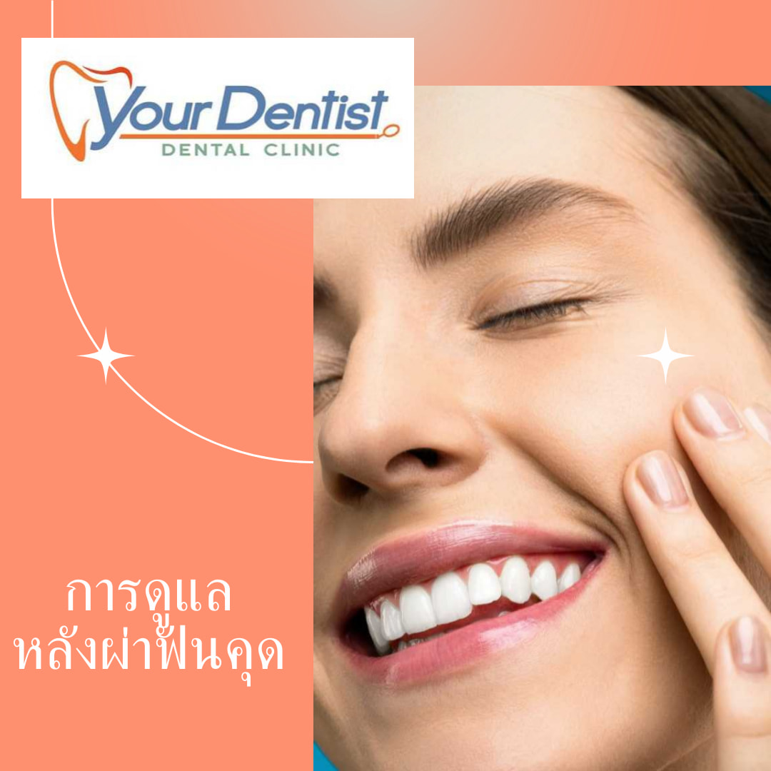 คลินิกทันตกรรม - หลังผ่าฟันคุด ควรปฏิบัติตัวอย่างไร? 1 ) หลังจากการถอน ...