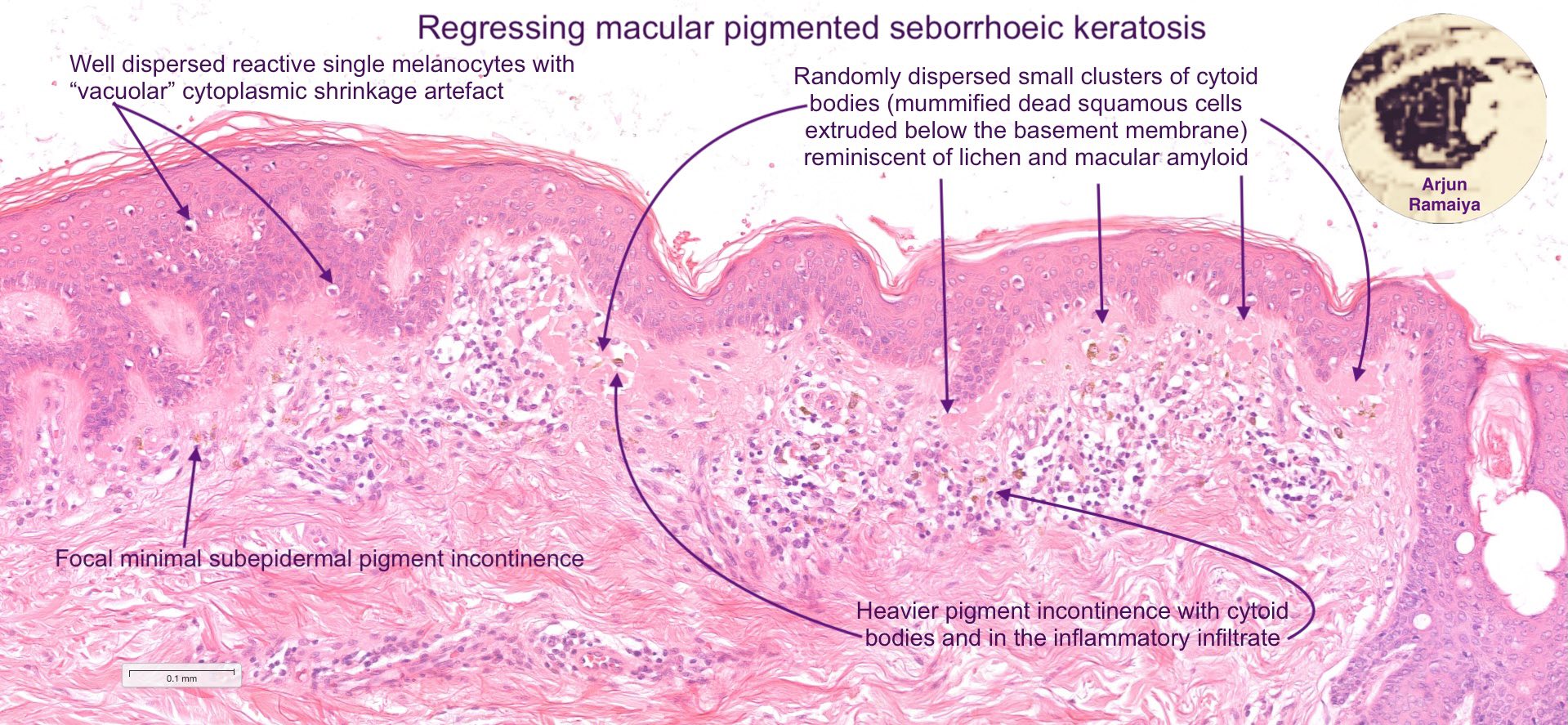 how long does melanotan last unmixed Melanotan-2 10mg  Research Peptide  THE SECRET BEAUTY STORE