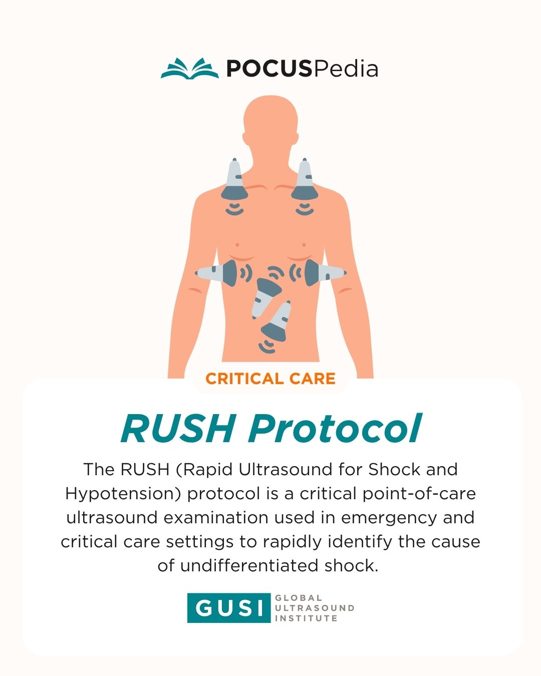 🚨 Critical Care Essential:... - Global Ultrasound Institute | Facebook