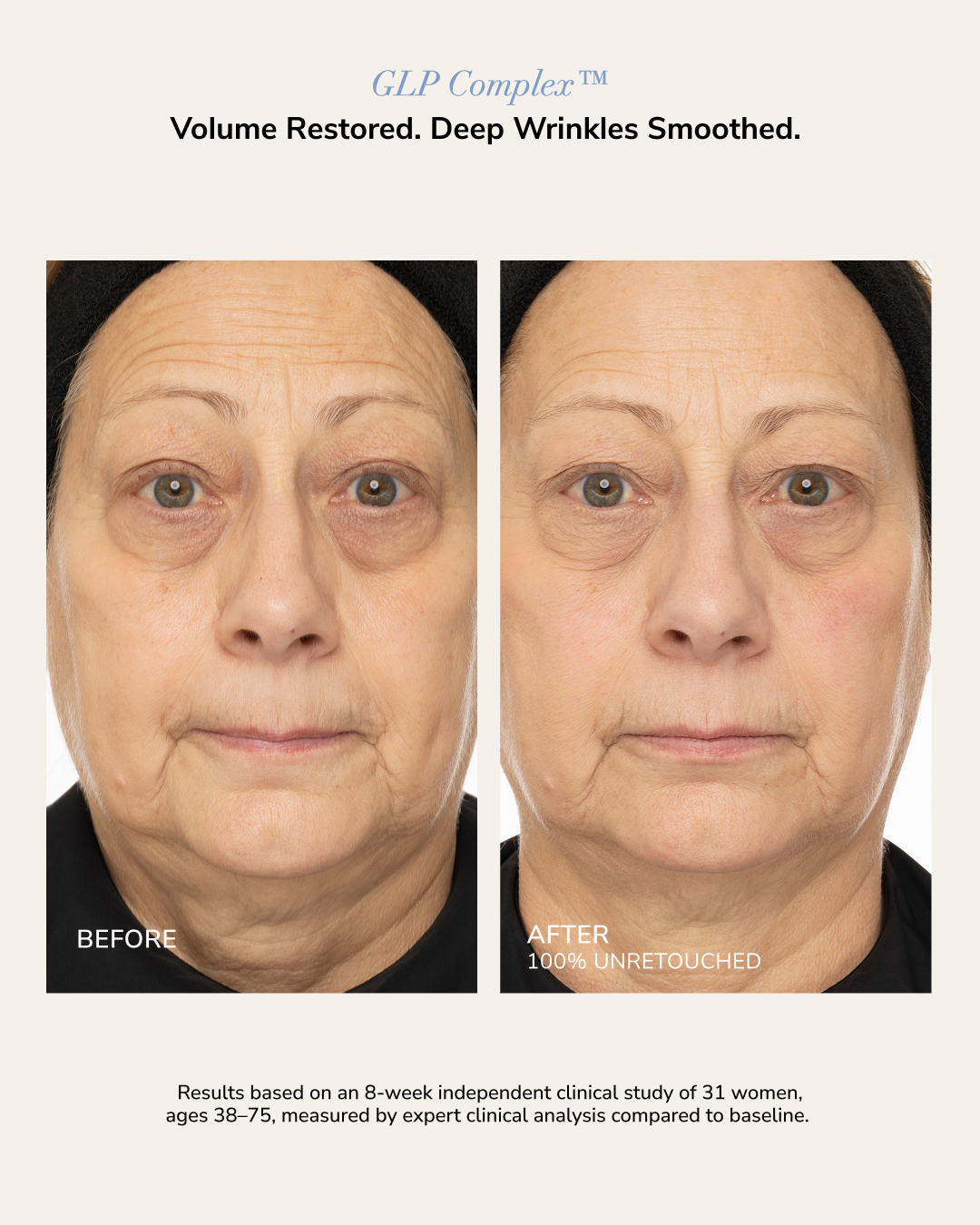 No filters. Just science. Aging isn't just wrinkles — it's volume loss, hollowing + lost firmness. GLP Complex™ with SenePlex+® & Exosomes was built for all of it. Swipe to see the