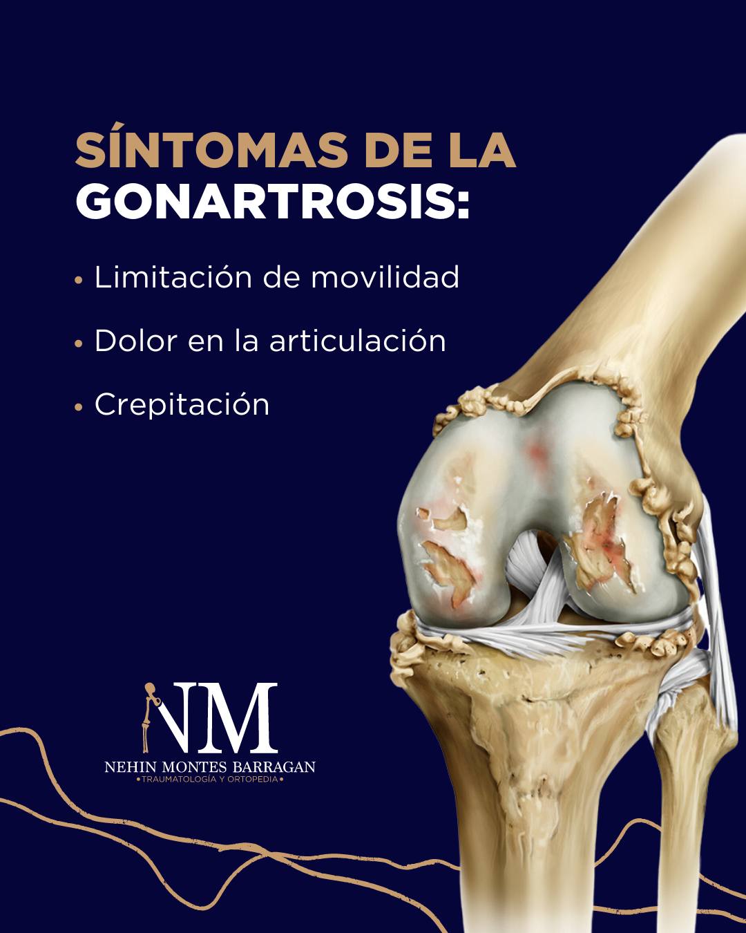 🦵 La gonartrosis es una... - Traumatólogo Dr. Nehin Montes | Facebook