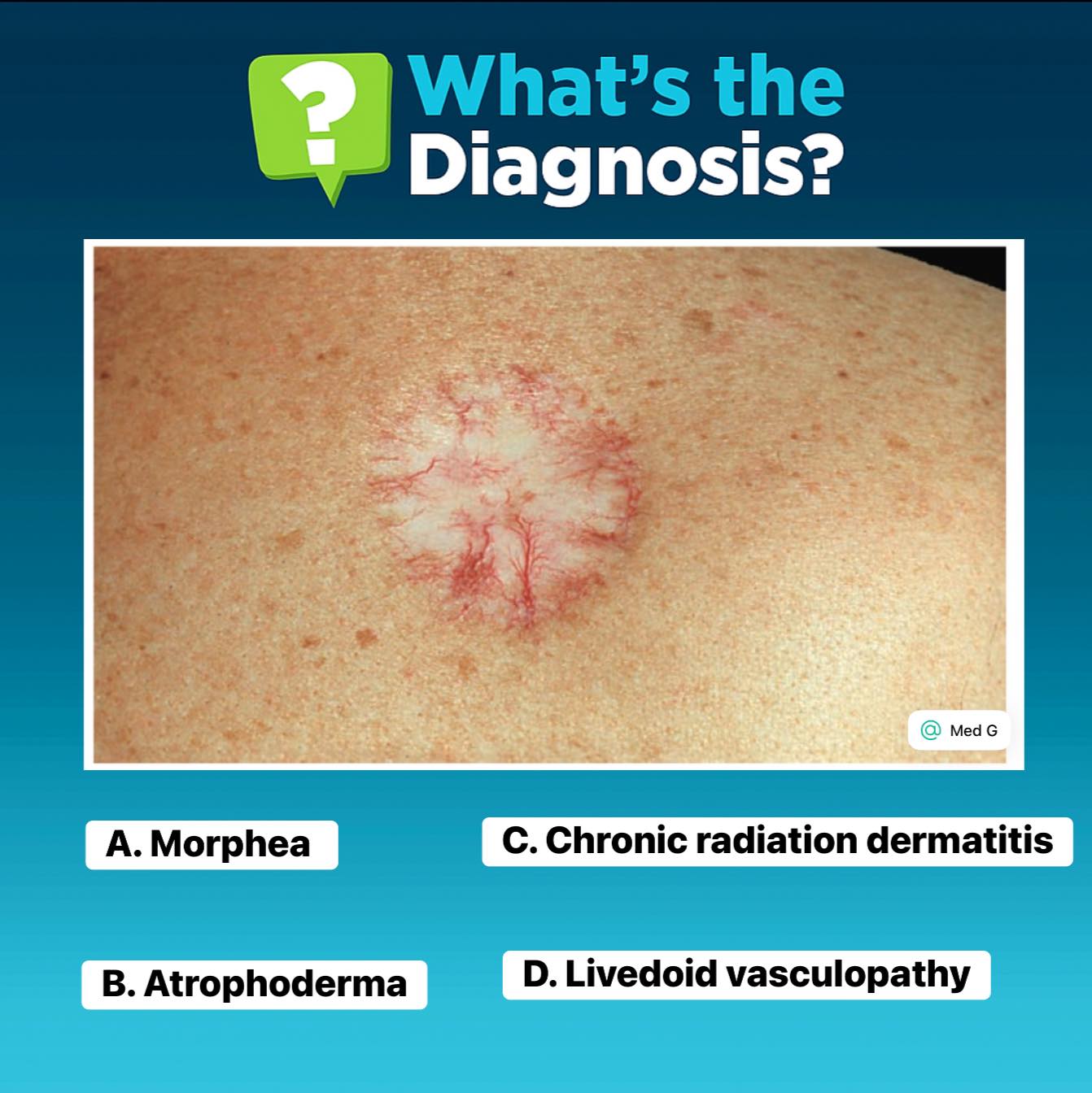Med G - A 35-year-old woman presents with a long-standing... | Facebook