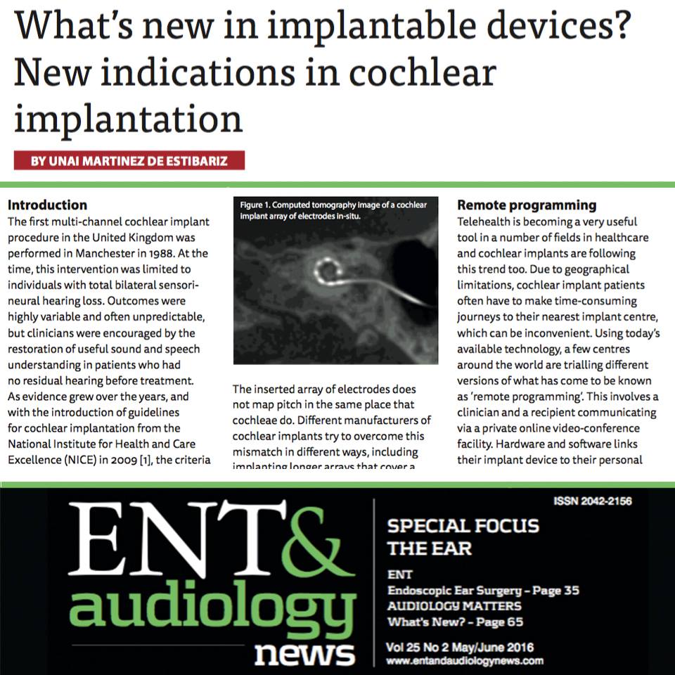 ENT - What’s new in implantable devices? New indications in cochlear ...
