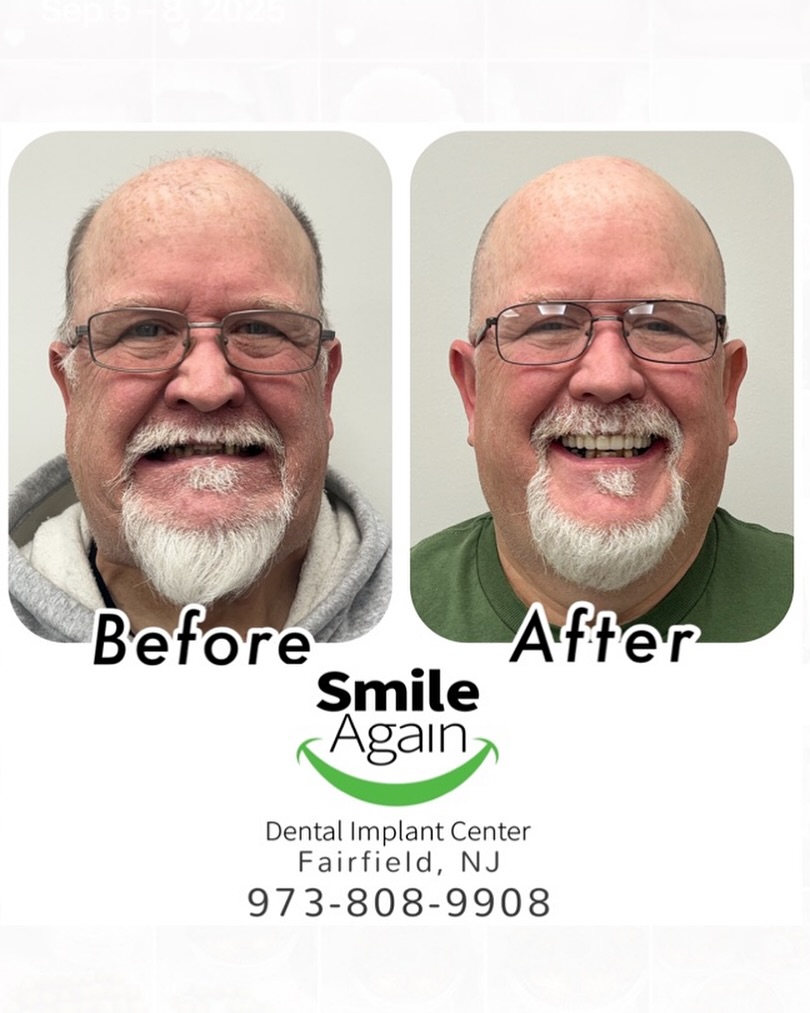 Smile Again Dental Implant Center | Fairfield NJ