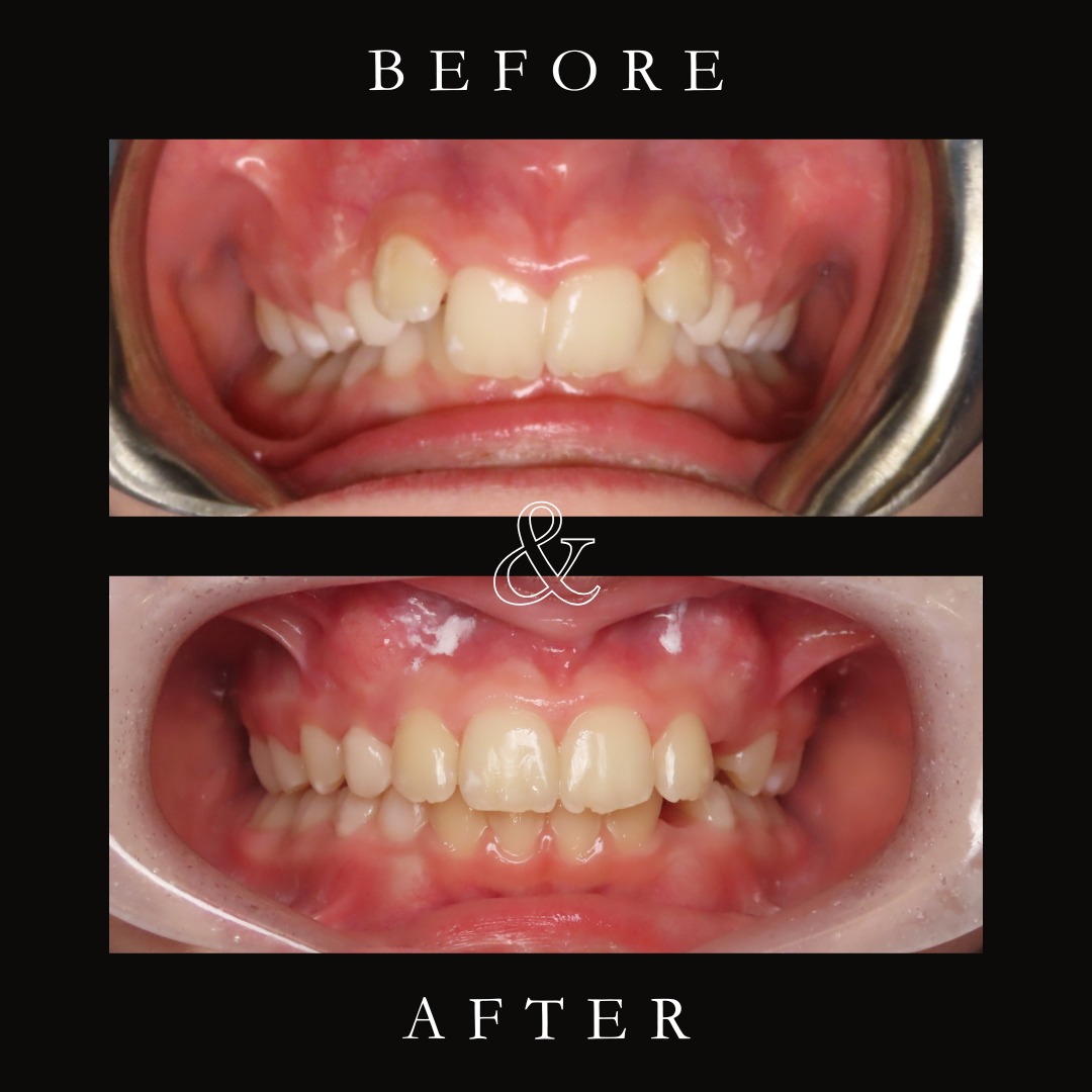 Advanced Orthodontic Care - Dr. Robert Rudman and Dr. Jeffrey Birg ...