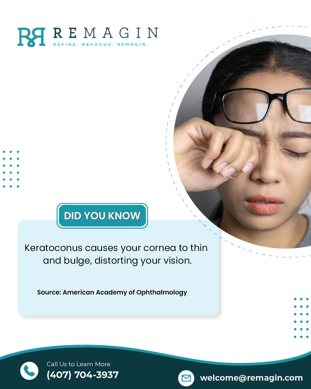 Remagin - Keratoconus can start in the teen years and progress without ...