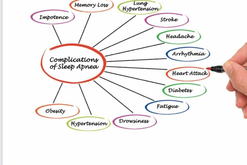 Apnées du sommeil et ronflements : la guérison par la chirurgie - Êtes ...
