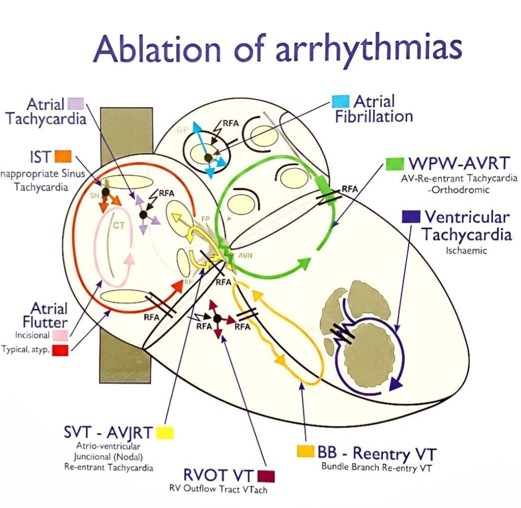 Cardiologia/Terapia intensiva. - Síguenos en:https://bit.ly/3E8GBoB ...