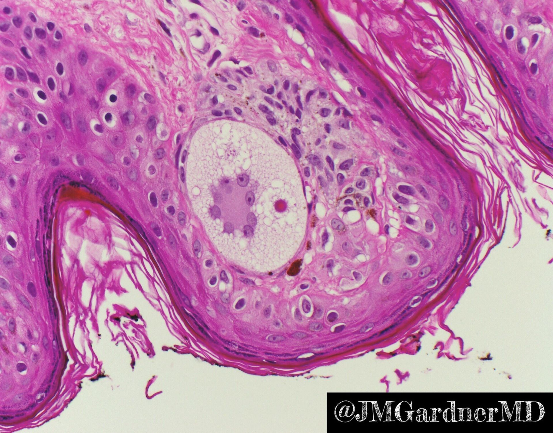 Jerad - What is this cell? What is the pink dot in its cytoplasm? What ...