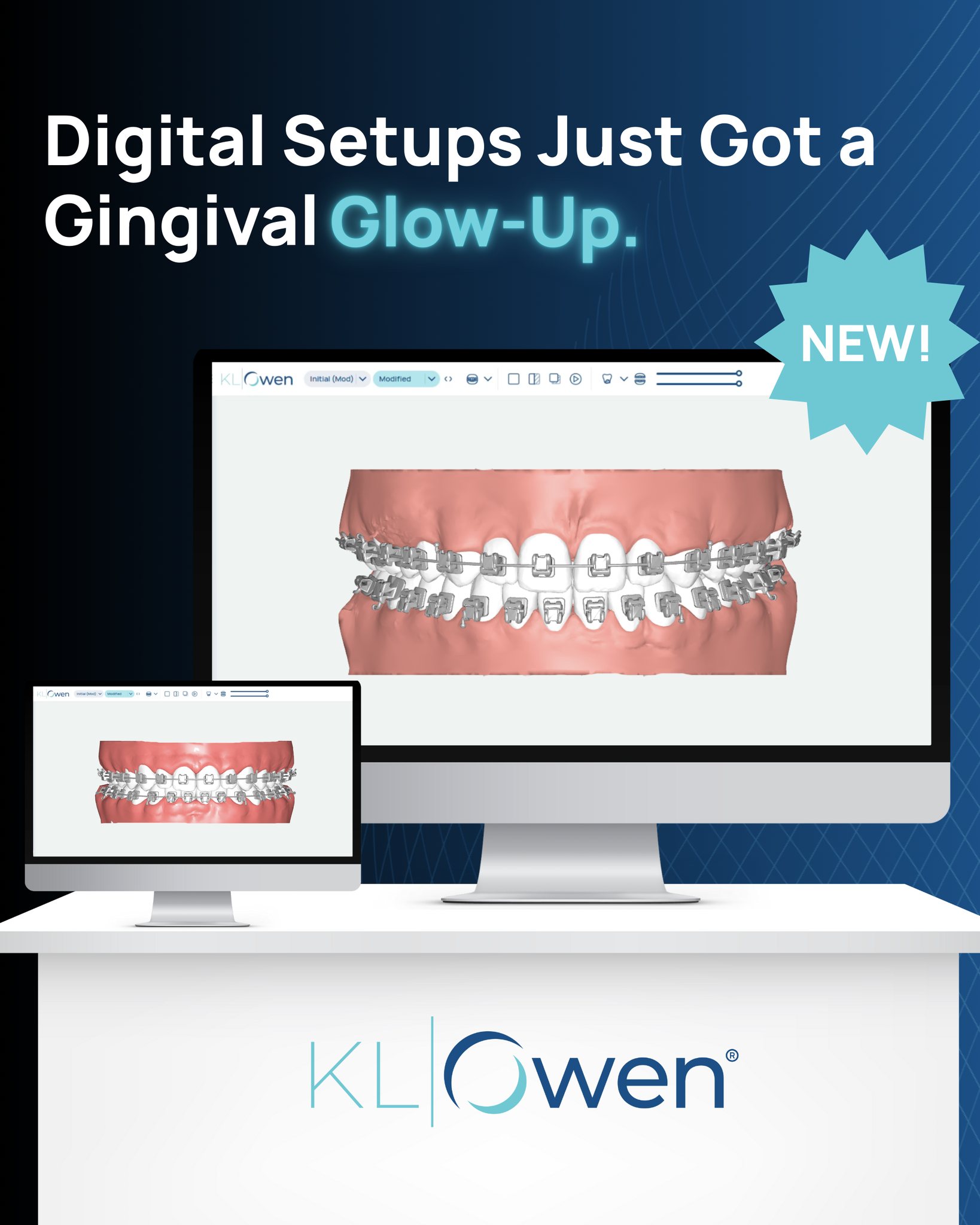 KLOwen Ortho - SprintRay Remote Event with Dr. Brandon Owen and ...