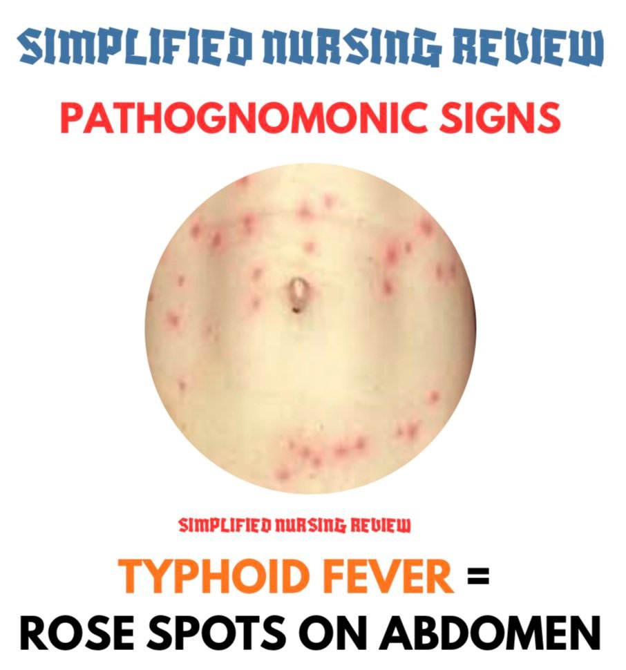 Simplified Nursing Review - PNLE, SPLE & NCLEX