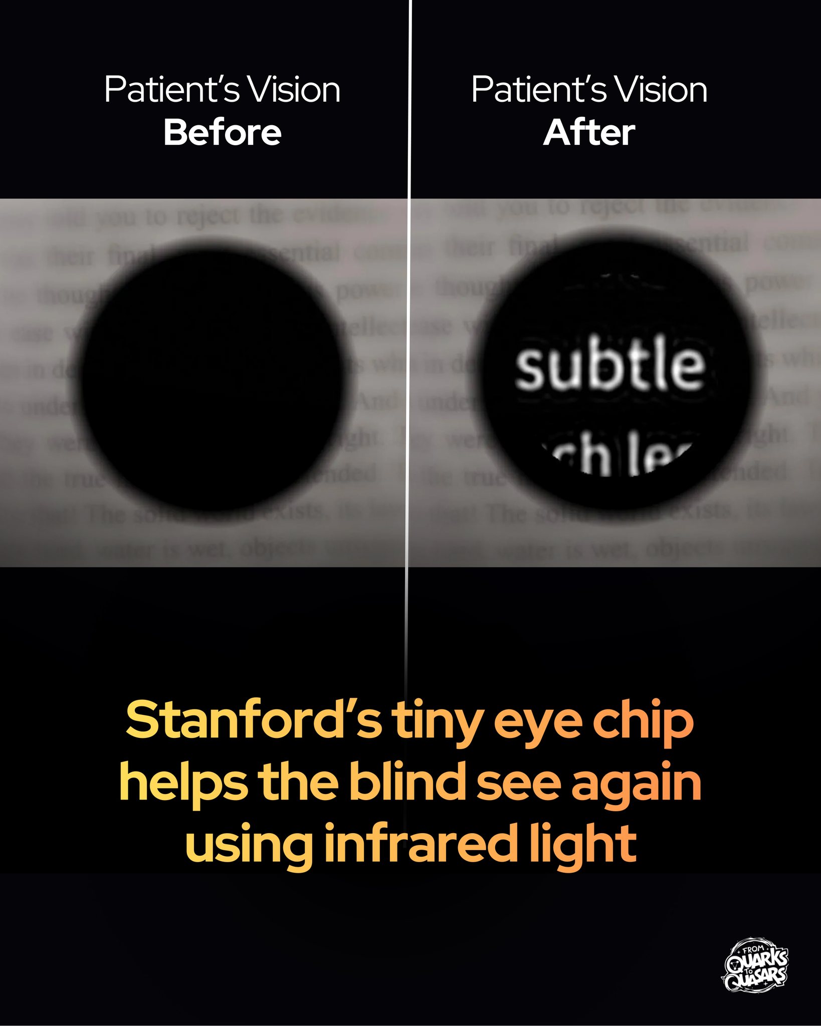 From - A bionic eye just helped the blind read again. In a ...