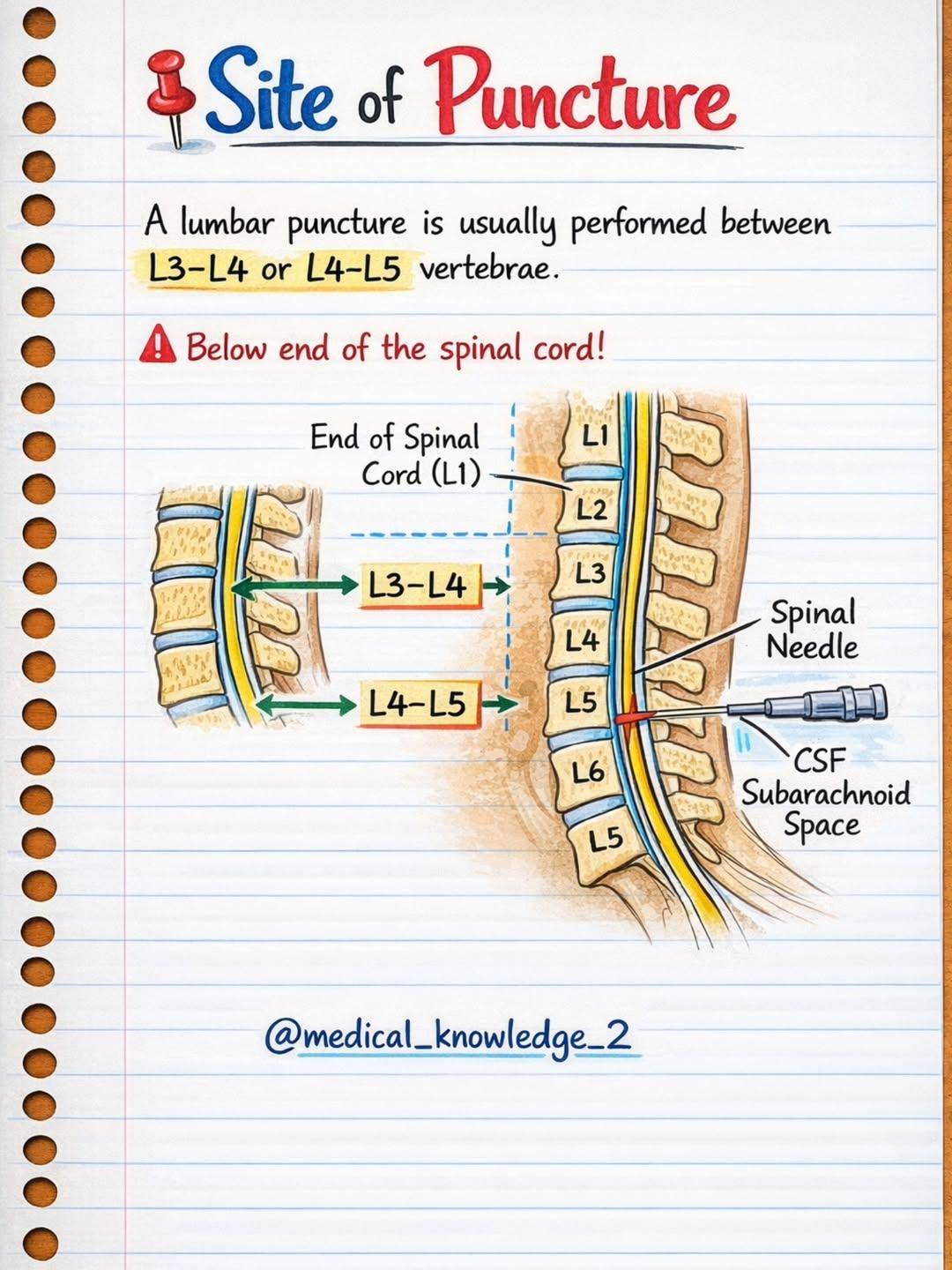 Lumber Puncture Notes :- 🧠 Lumbar... - Medical Information | Facebook