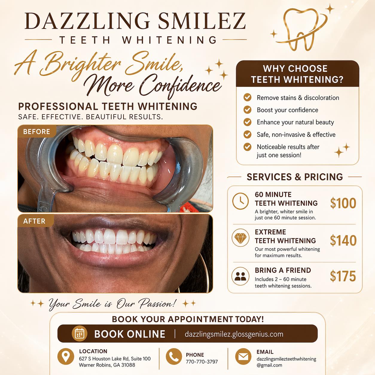 Teeth whitening service in Warner Robins