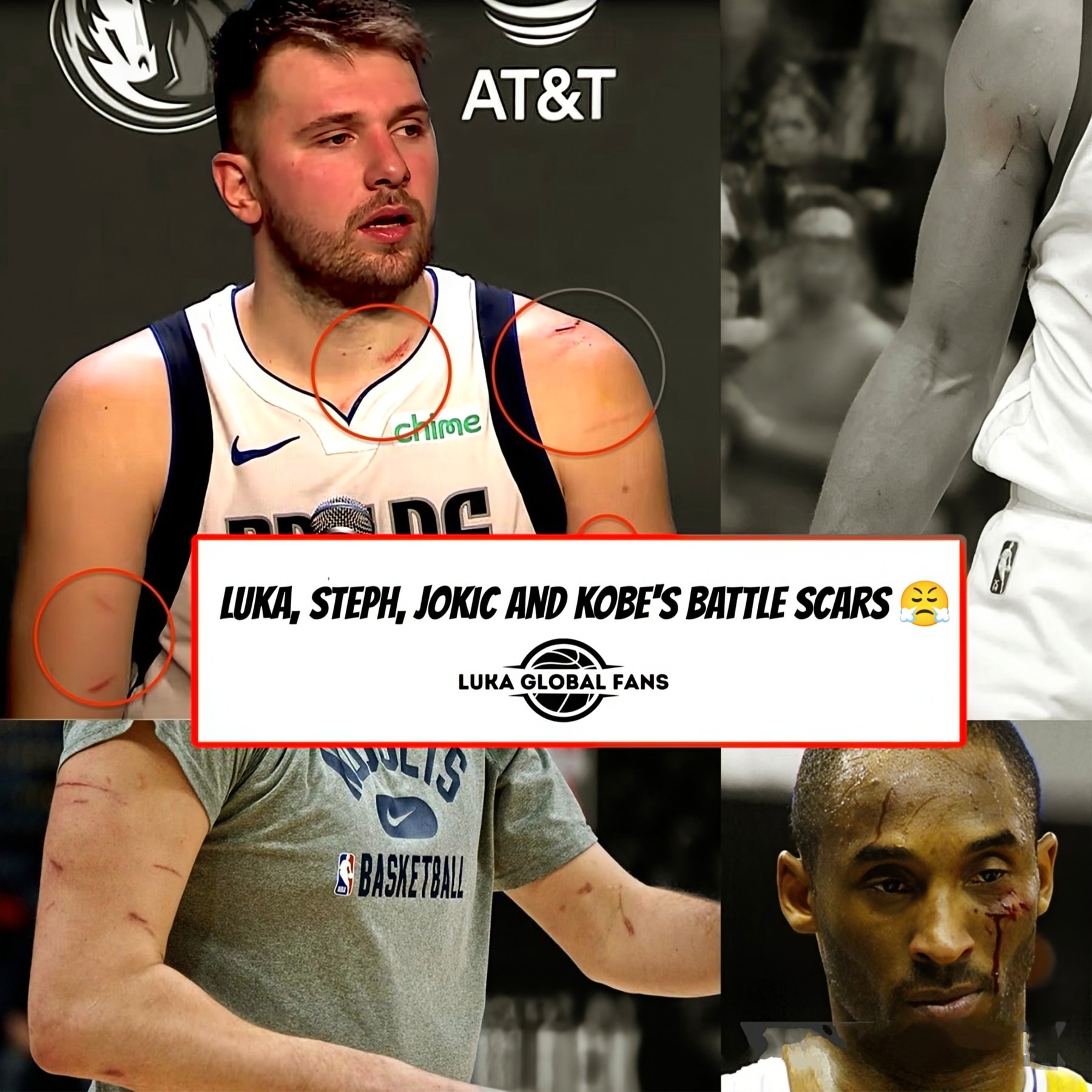 Luka - 💥🏀 Every Scar Tells a Story 🏀💥 The hardwood isn’t just sweat and ...