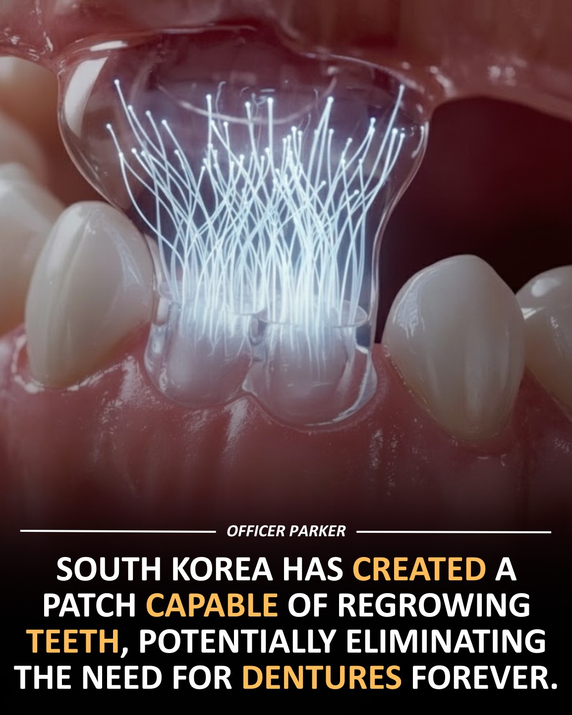 Officer - South Korean researchers are testing a bioactive patch that ...