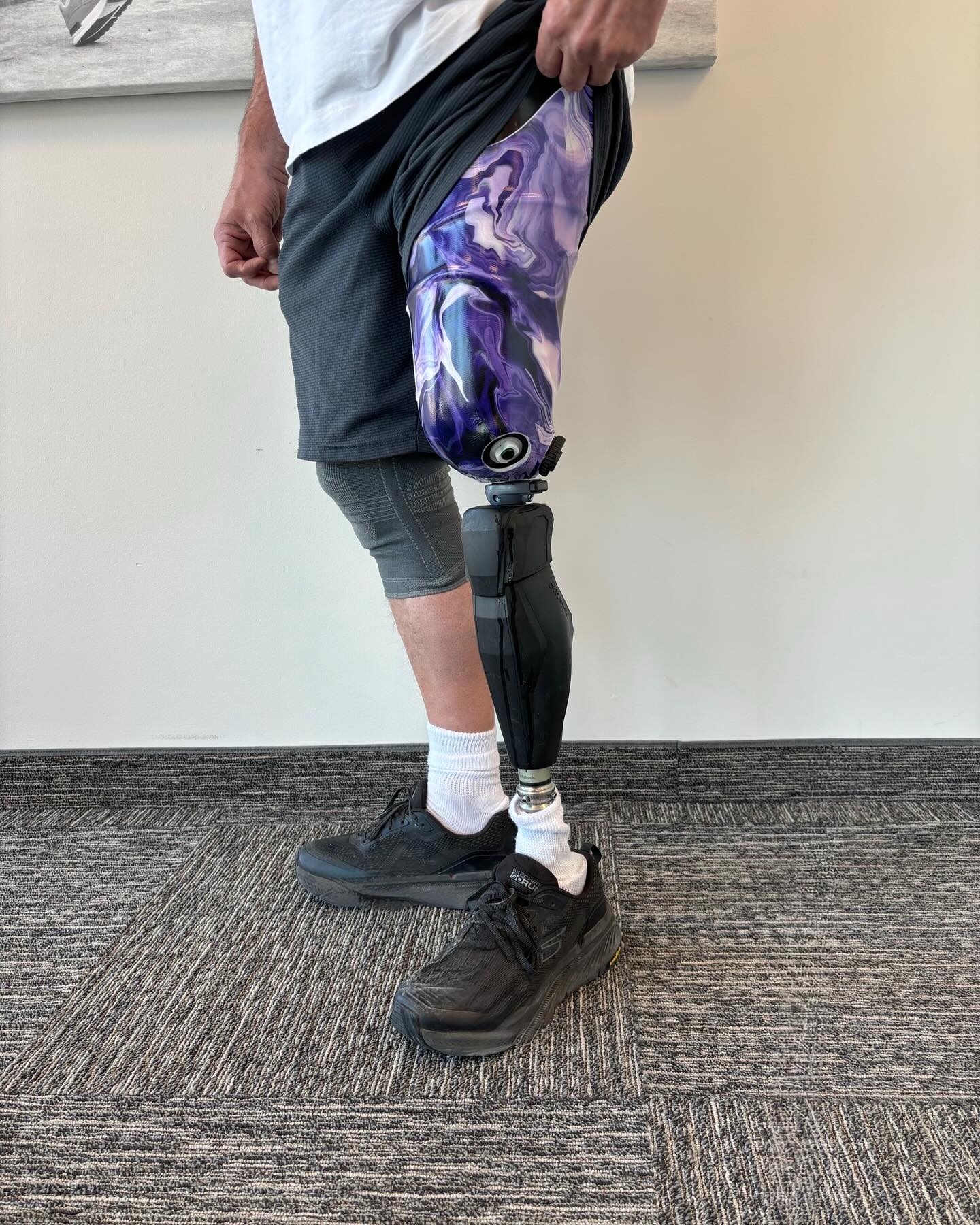 Colman Prosthetics & Orthotics | Calgary AB