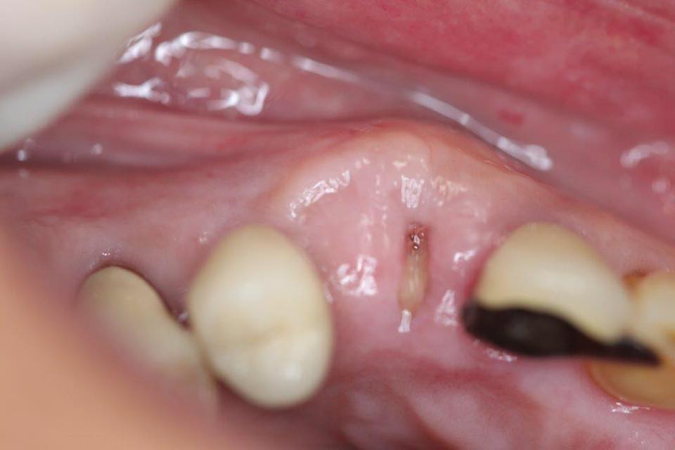 Infusion dental arts LLC | El Dorado Hills CA