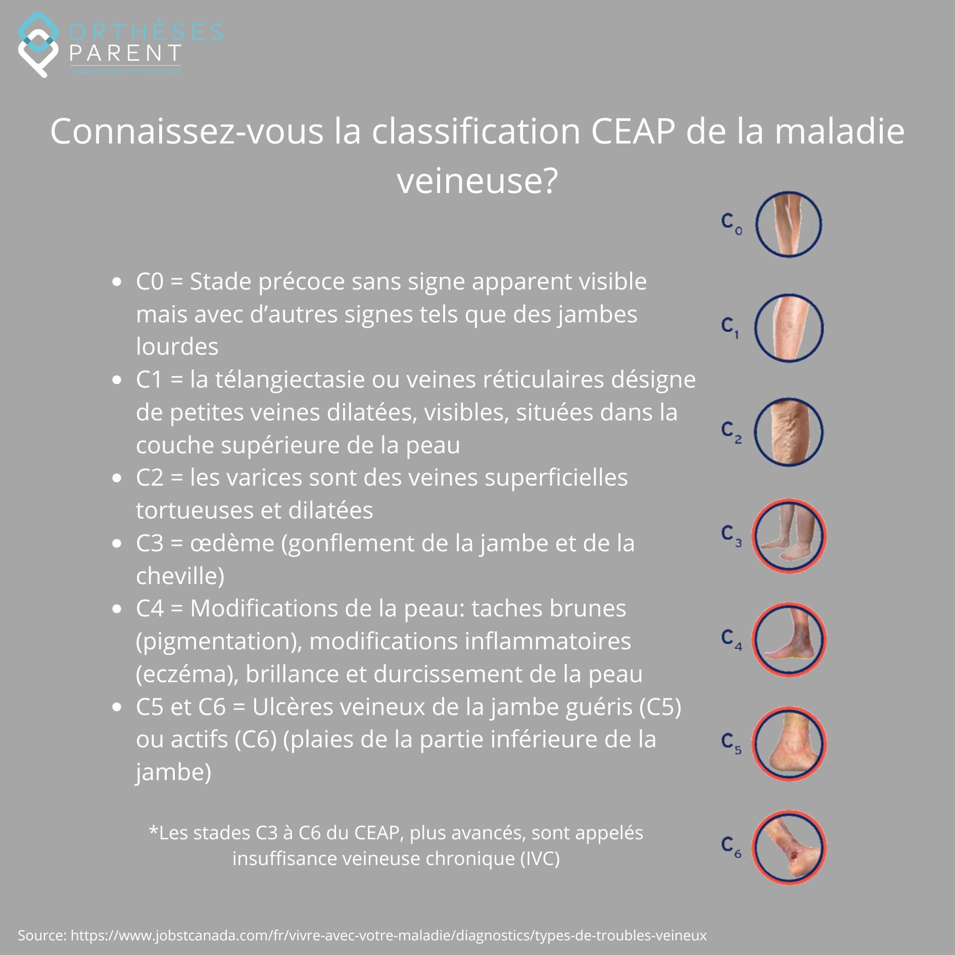 Orthèses - Quelles sont les solutions pour la maladie veineuse? Selon ...
