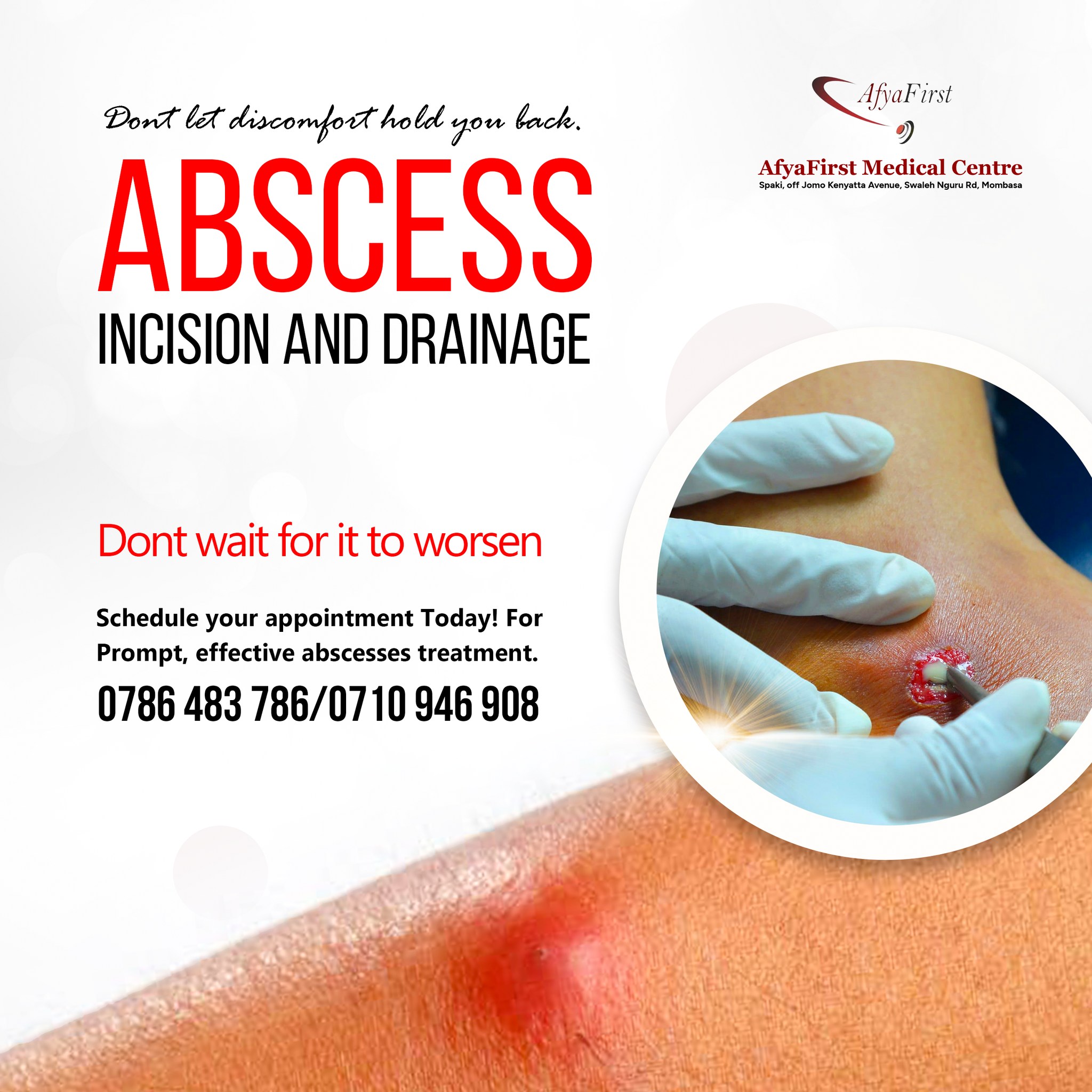 Afyafirst - VISIT AFYAFIRST MEDICAL CENTRE FOR SAFE, SAME-DAY ABSCESS ...