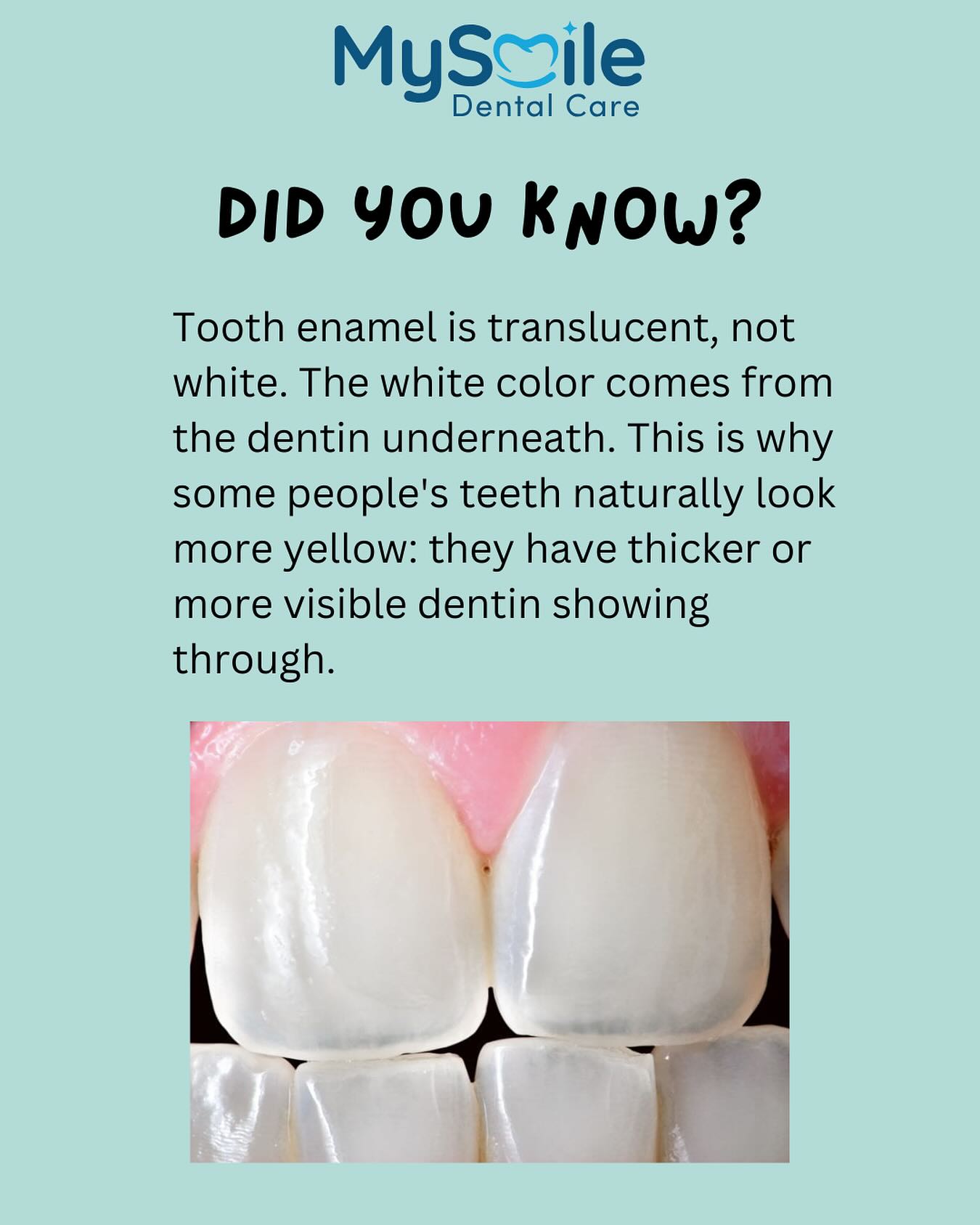 MySmile - Tooth enamel is translucent, not white. The white color comes ...