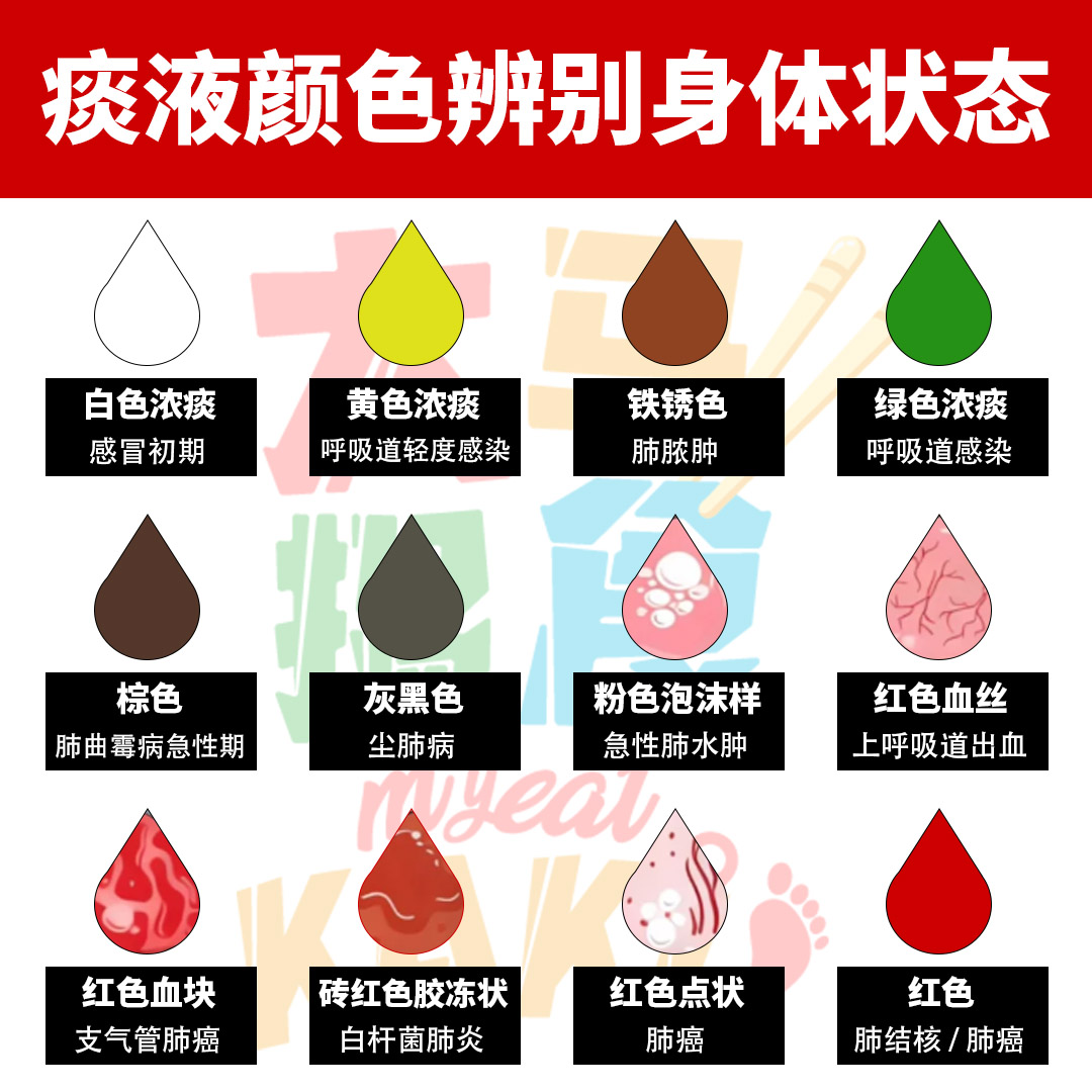大马搵食Kaki - #健康KAKILang 痰液颜色辨别身体状态😷 . 最近因为天气忽冷忽热，加上病毒的来袭😖身边很多家人朋友都开始 #生病 ...
