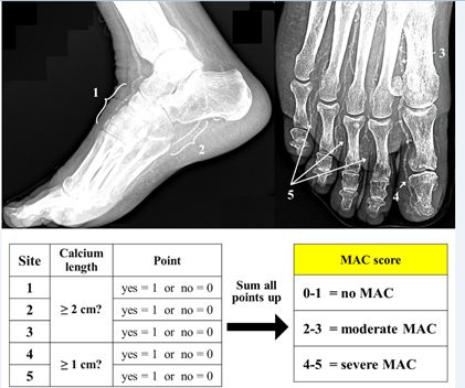 David - Could the MAC Score be a Game-Changer in Assessing Patients ...