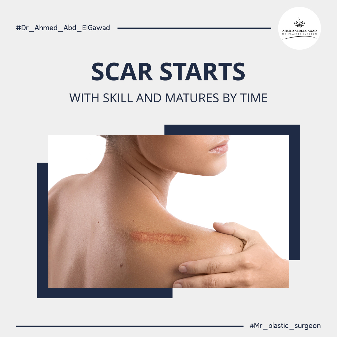Mr - Every surgical incision forms a scar — but its appearance improves ...