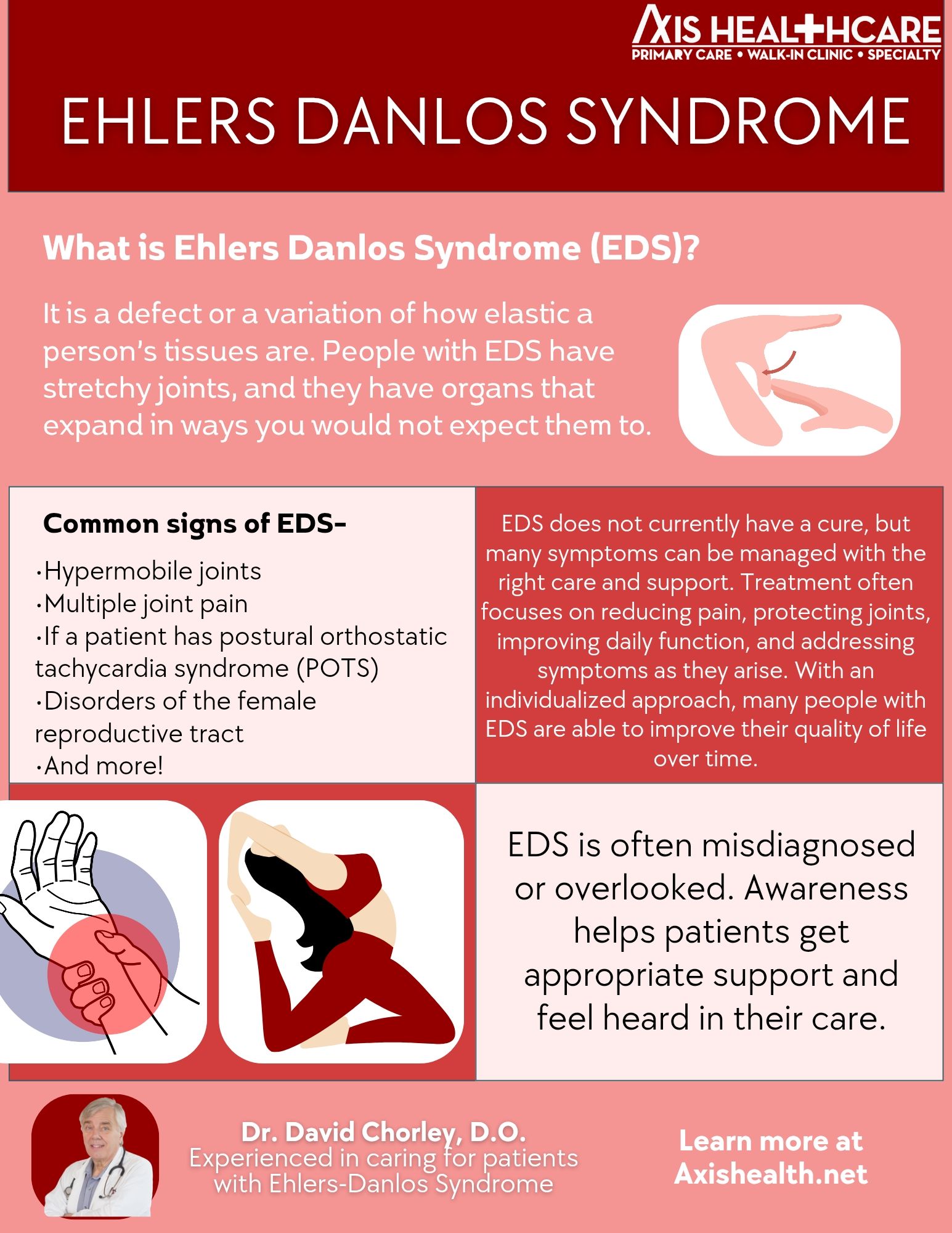 Axis - Ehlers-Danlos Syndrome is a lifelong condition, but with ...