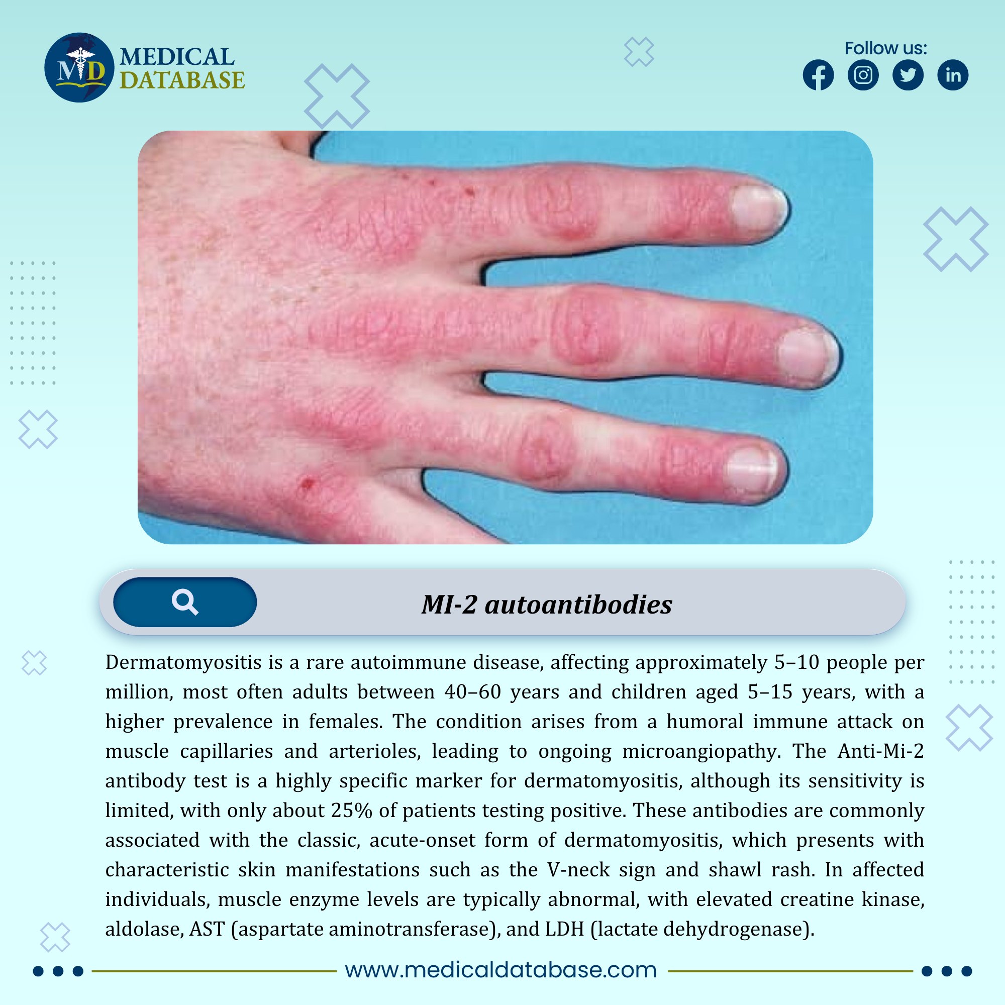 Medical - Dermatomyositis is a rare autoimmune disease, affecting ...