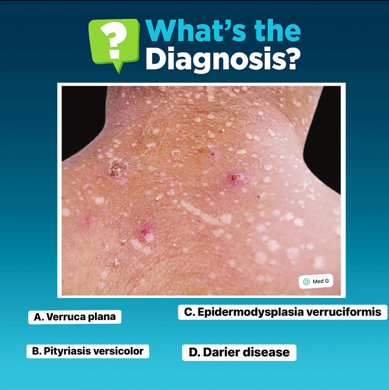 Med - A 17-year-old adolescent boy presents with numerous asymptomatic ...
