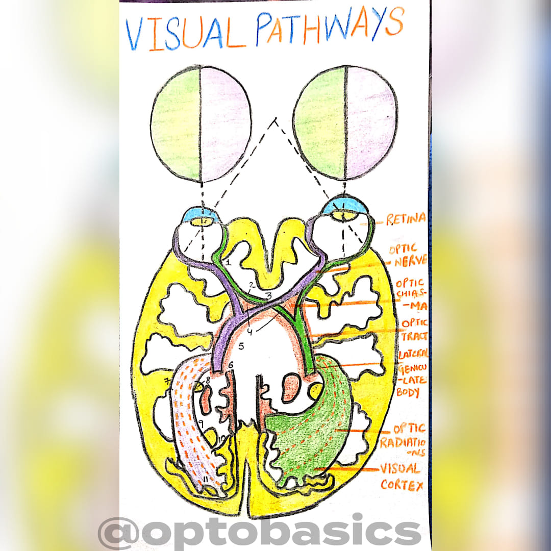 Theeyeroom - VISUAL PATHWAY #visualpathway #optomlearning #opticnerve # ...