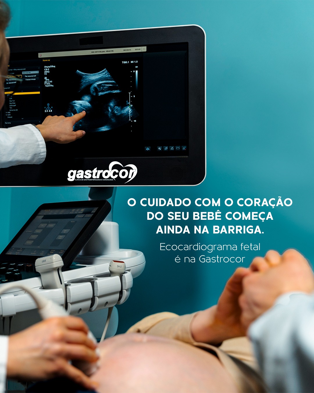 Gastrocor - O ecocardiograma fetal é um exame fundamental para avaliar ...